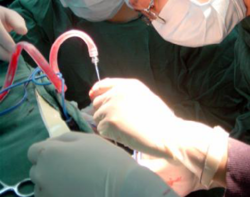 中醫(yī)微(wēi)創可(kě)視(shì)針刀(dāo)鏡技(jì)術(shù)