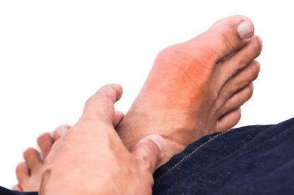 痛風(fēng)一(yī)般哪個(gè)部位疼?